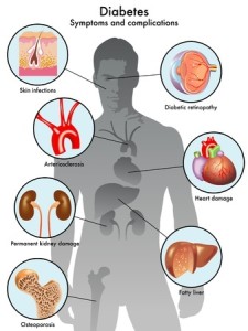 Komplikasi Kronis, Akibat Diabetes Melitus yang Sebisa Mungkin Dihindari (Bag 2)